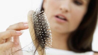 Tại sao tóc rụng nhiều? Làm thế nào để ngăn ngừa rụng tóc hiệu quả?
