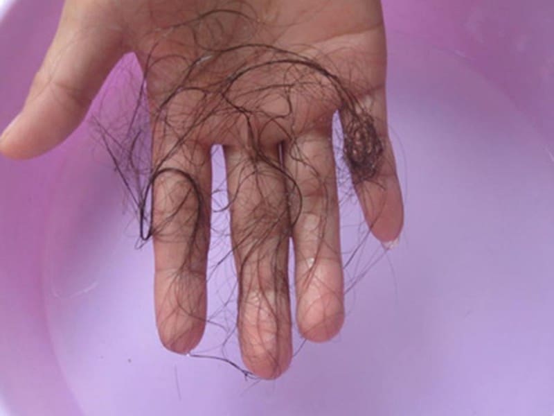 Chăm sóc tóc sai cách là nguyên nhân tại sao tóc rụng nhiều