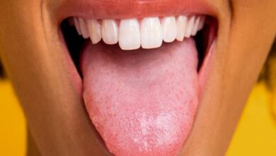 Lưỡi trắng kèm hôi miệng: Tìm hiểu nguyên nhân và cách điều trị