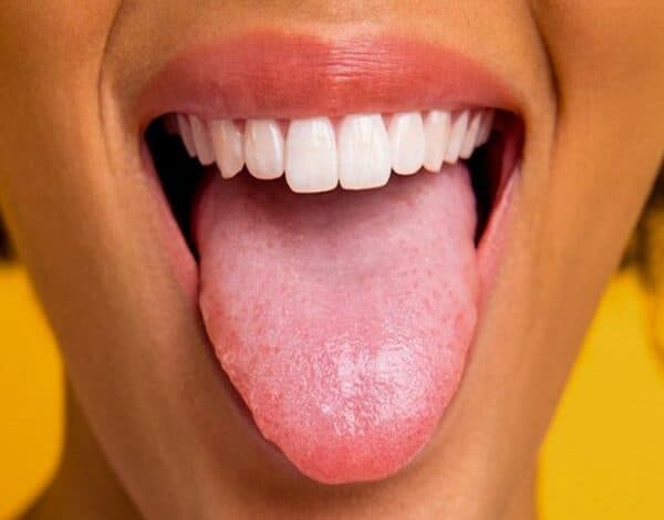 Lưỡi trắng kèm hôi miệng: Tìm hiểu nguyên nhân và cách điều trị